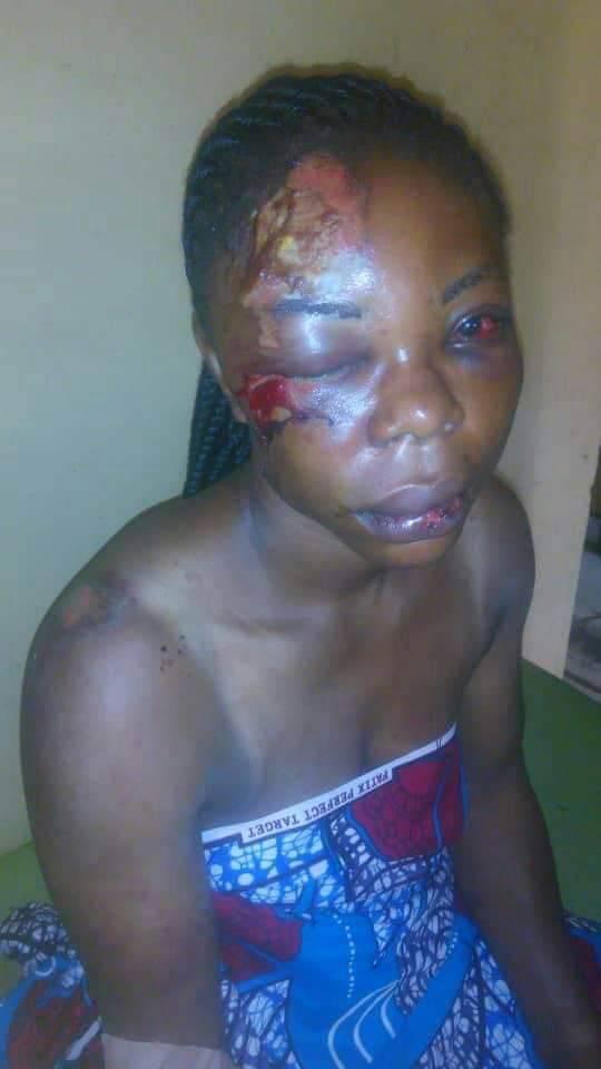 Nigerian woman's face disfigured