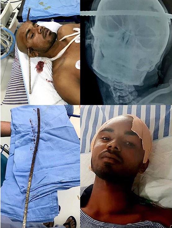Indian man survives