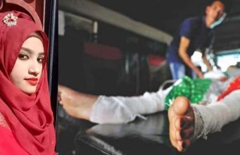 Teenage student burnt