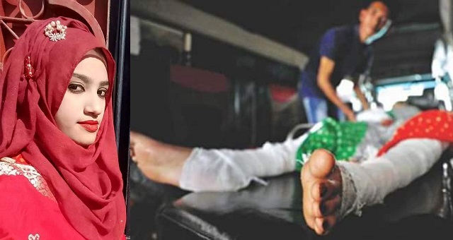 Teenage student burnt