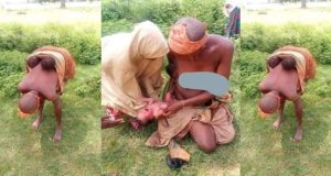 Mentally challenged woman gives