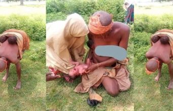 Mentally challenged woman gives