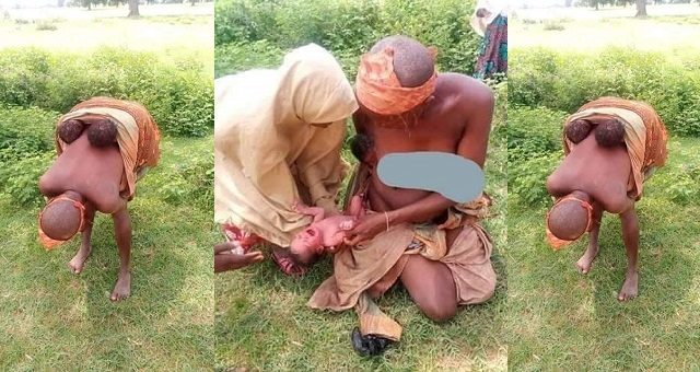 Mentally challenged woman gives