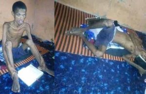 Ebonyi Student Hospitalized