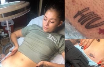 Lady tattoos HIV