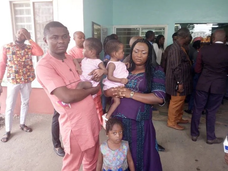 78 doctors successfully separate one-year-old Nigerian conjoined twins