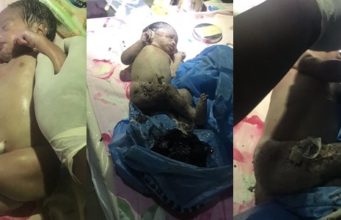 Nigerian doctor recounts