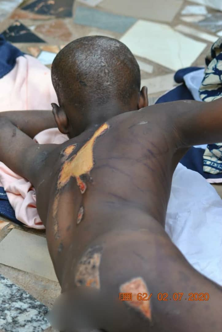 Nigeria : elle perce la tête de sa travailleuse domestique avec des clous et brûle son corps (photos)