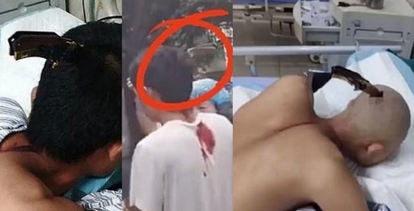 knife stuck in head1