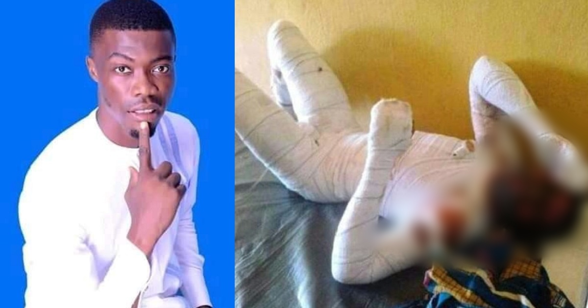 Man dies after his 18-year-old girlfriend set him ablaze over marriage