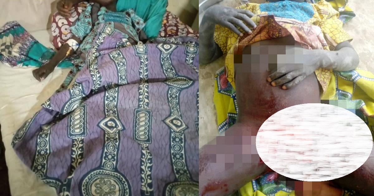 Ritualists completely cut off private part of 6-year-old girl (Graphic photo)