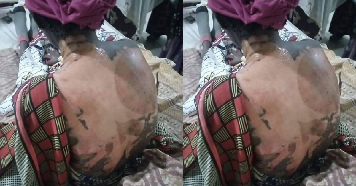 Woman pours hot water on her co-wife and 4-year-old stepdaughter in Kano
