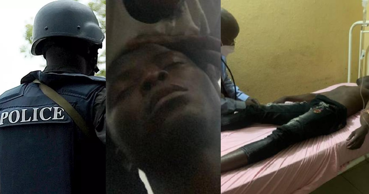 Police officer accused of torturing UNILAG student to coma