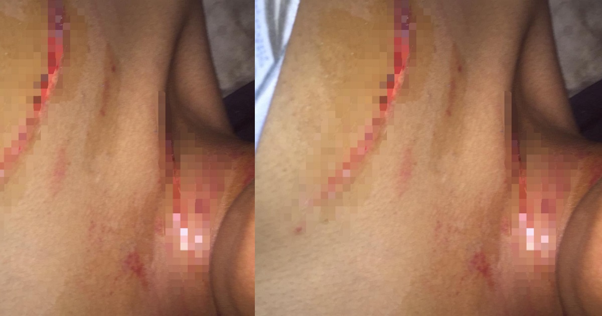“Please help me” – Video vixen accuses her boyfriend of domestic violence with photo evidence