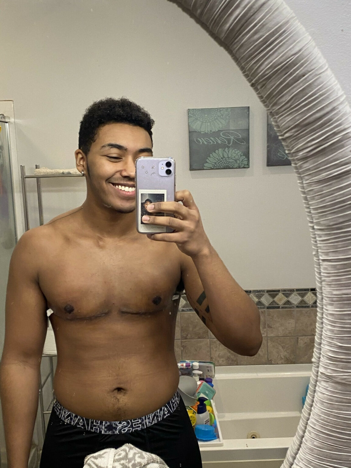 Trans man shows off his chest after undergoing breast removal surgery