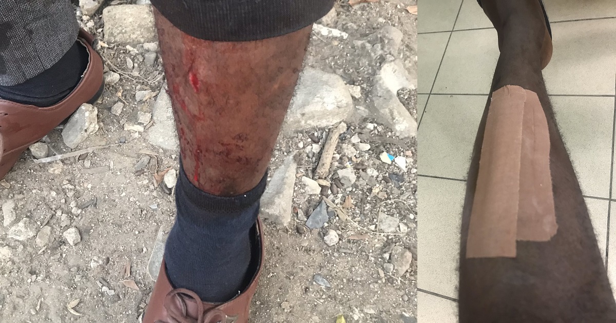 Man cries out after falling victim to ‘one-chance’ robbers in Lagos State