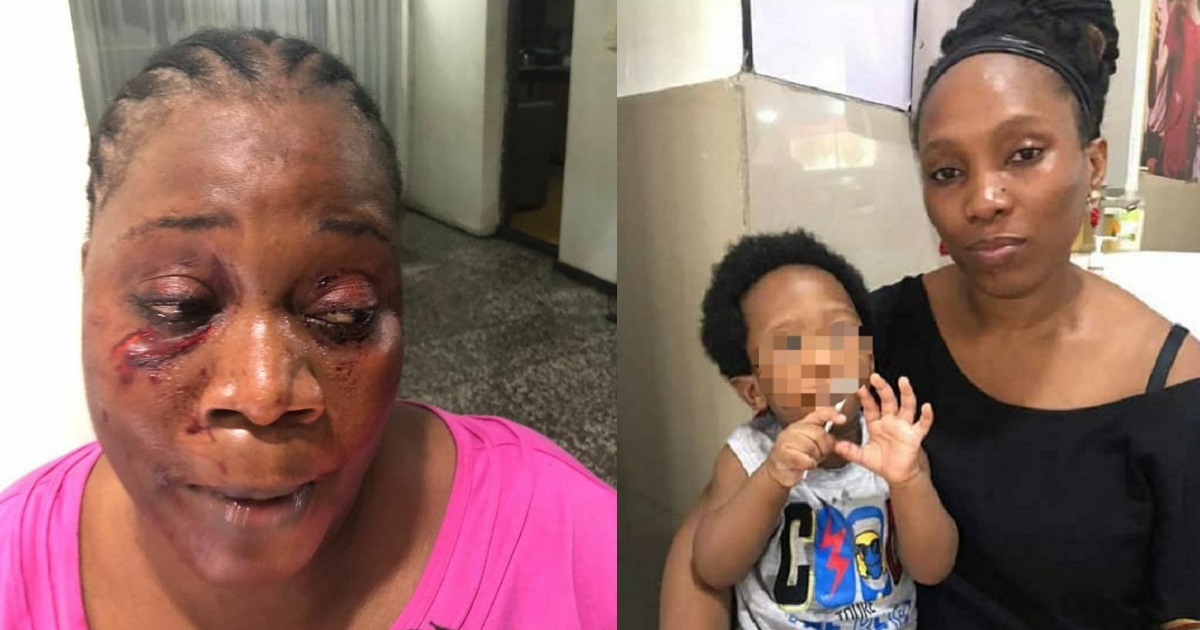 Woman allegedly disfigures her neighbour’s face for reporting her actions in the compound to their lawyer