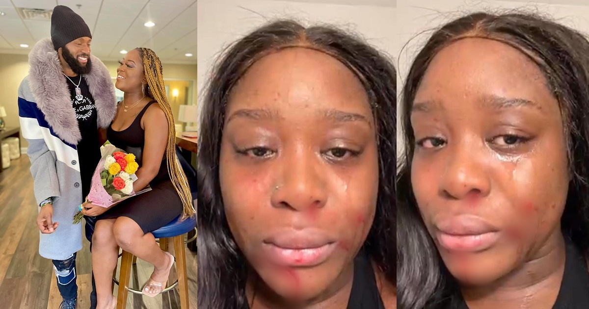 Baby mama of Liberian celebrity chef calls him out for allegedly assaulting her (Photos)