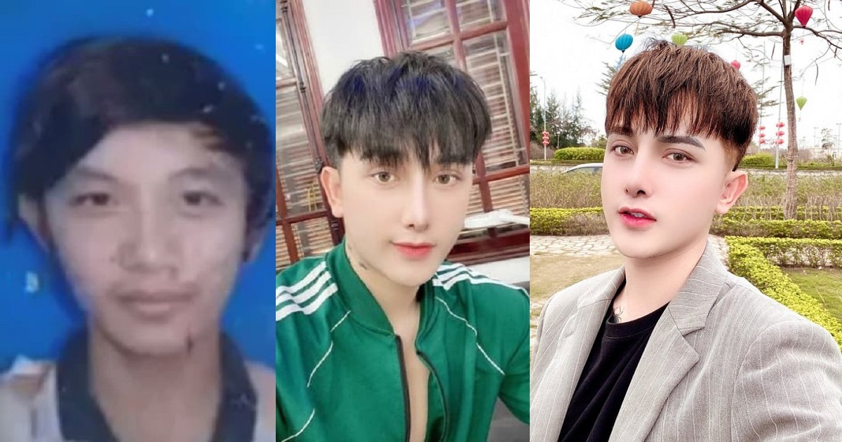 Man undergoes N6.6m plastic surgery transformation after he was denied a job because of his looks (Photos)
