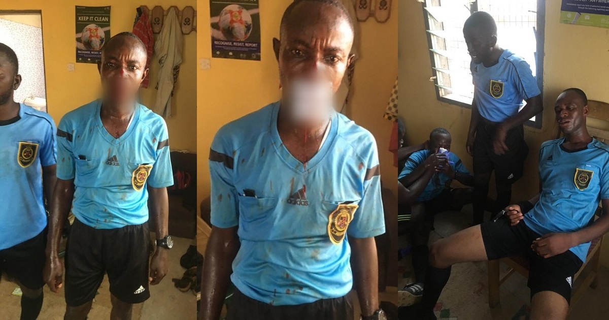 Angry football fans mercilessly beat up match officials with center referee losing some of his teeth in Ghana (Photos)