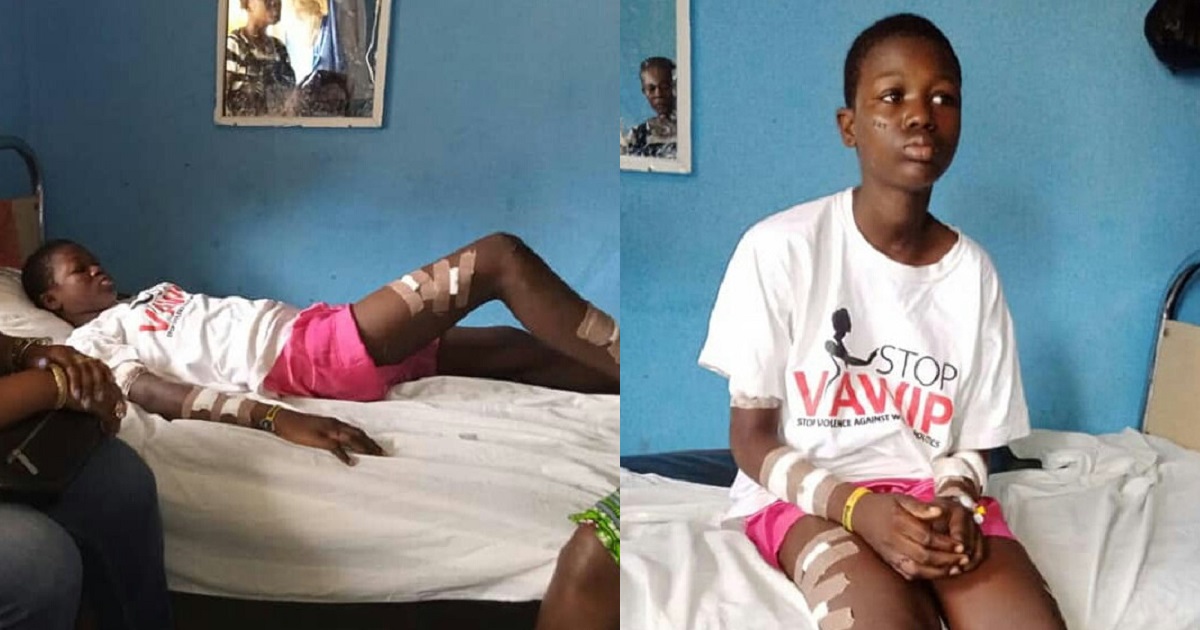 Woman slashes her 13-year-old daughter with razor blade over alleged theft of N1,500 in Bayelsa