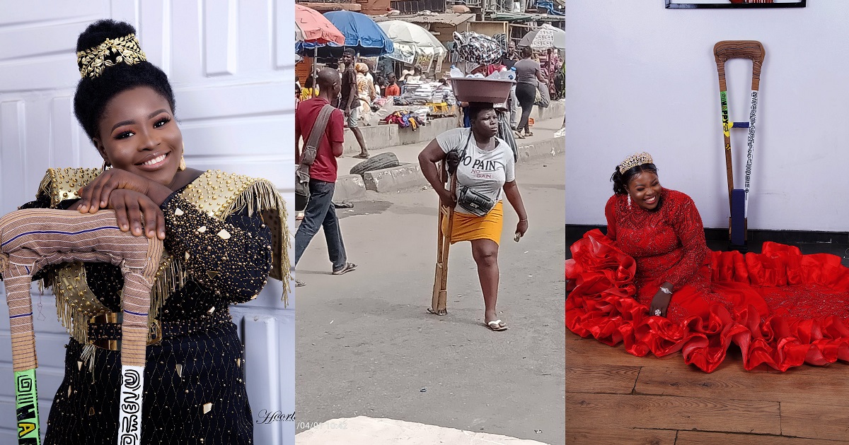 Viral amputee hawker who claims to have lost her leg and parents in an accident was telling a lie to extort money from Nigerians (DETAILS)