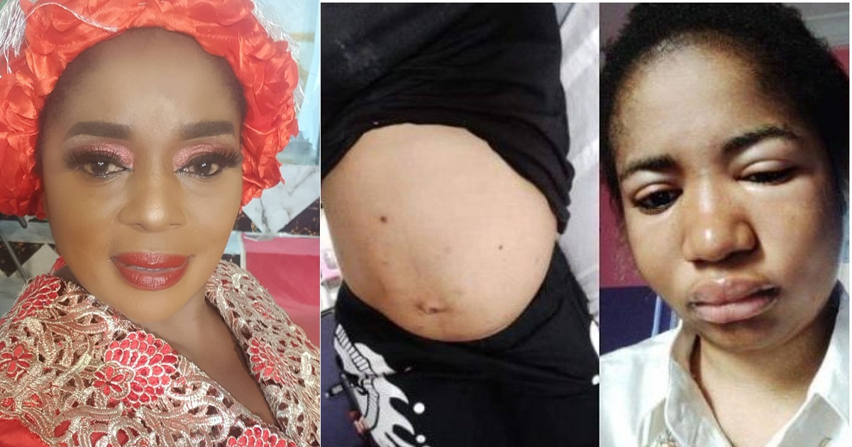 Actress Rita Edochi, finally forgives ailing comedienne, Ada Jesus. (Video)