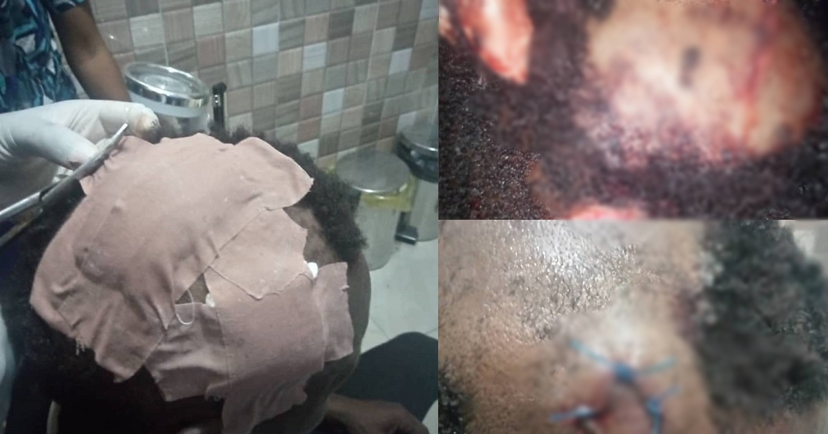 Caterer allegedly attacked by groom’s brothers over small chops at wedding (graphic photos)