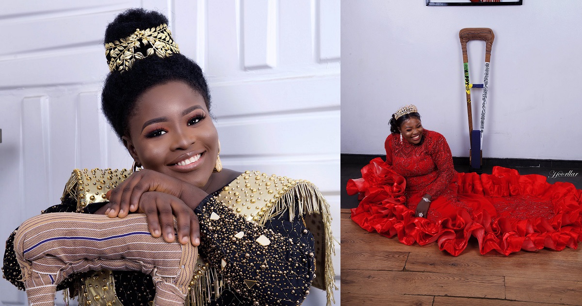 Amputee Lady who used to hawk for survival has been totally transformed in new photos