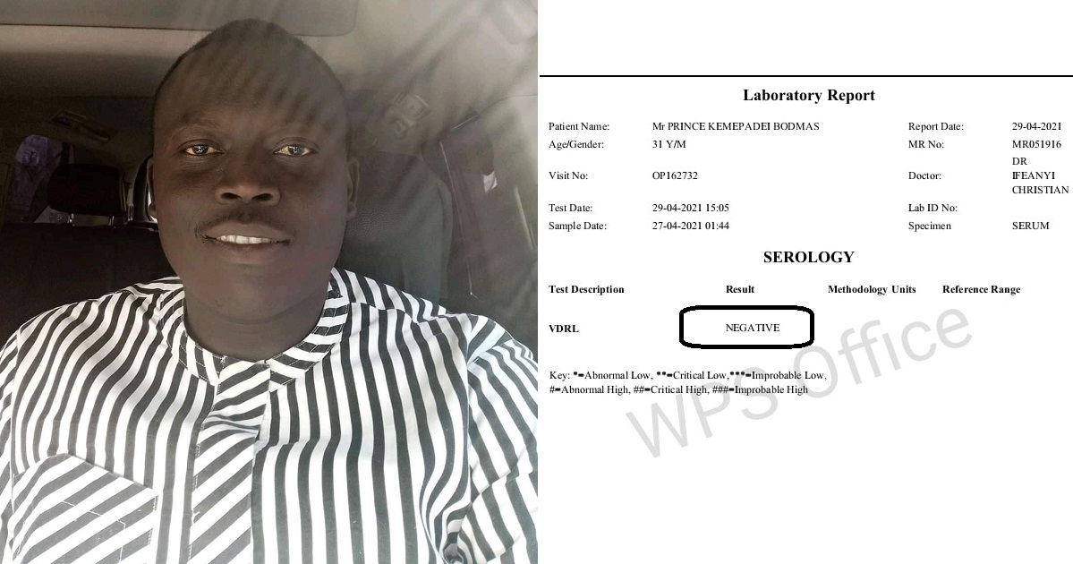Nigerian man who has multiple partners shares his HIV test results, challenges critics and ‘saints’ to do same