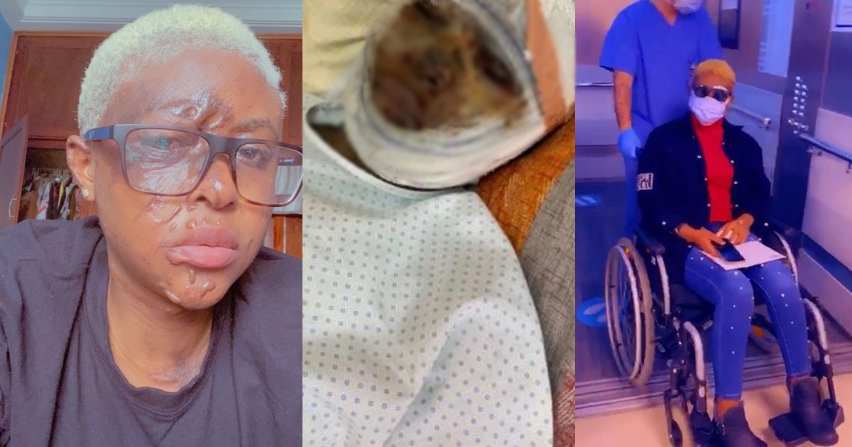 Lady recounts how her envious neighbour masterminded an attack on her