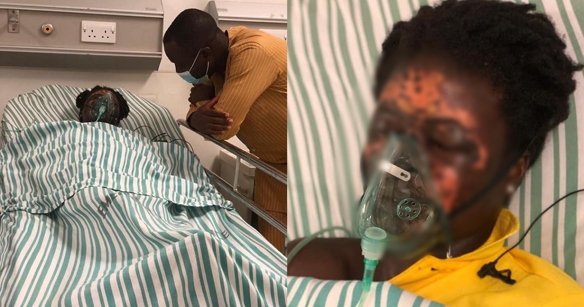 Man allegedly bathes wife with acid in Ghana
