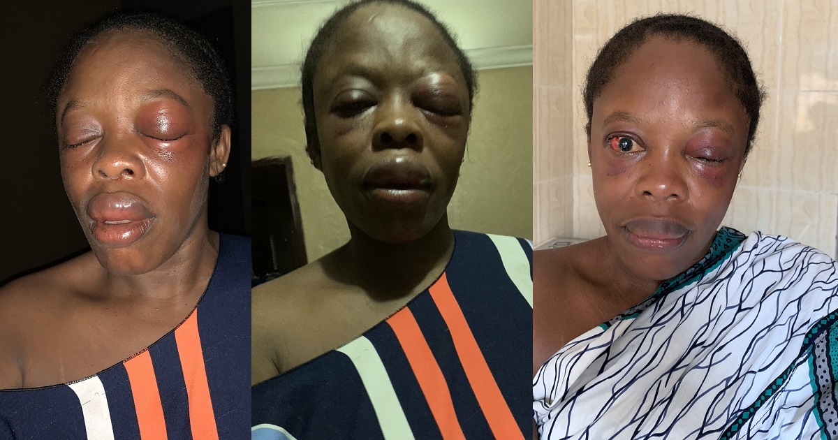 Teacher lucky to be alive after she encountered one-chance operators in Lagos state (photos)