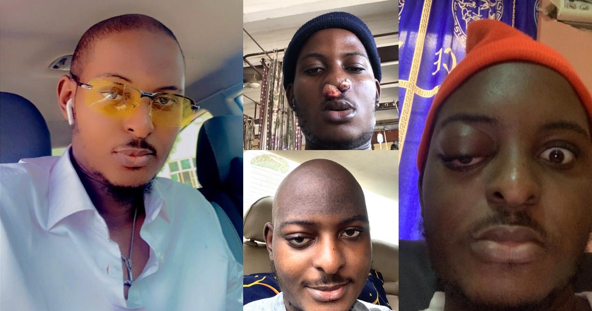 Nigerian music producer, Fayabeats, beats three types of cancers in one year