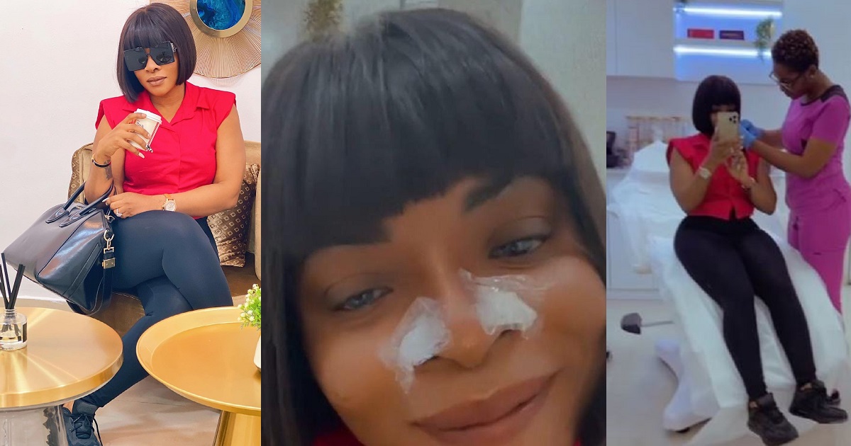 Laura Ikeji revisits a surgeon for her nose job