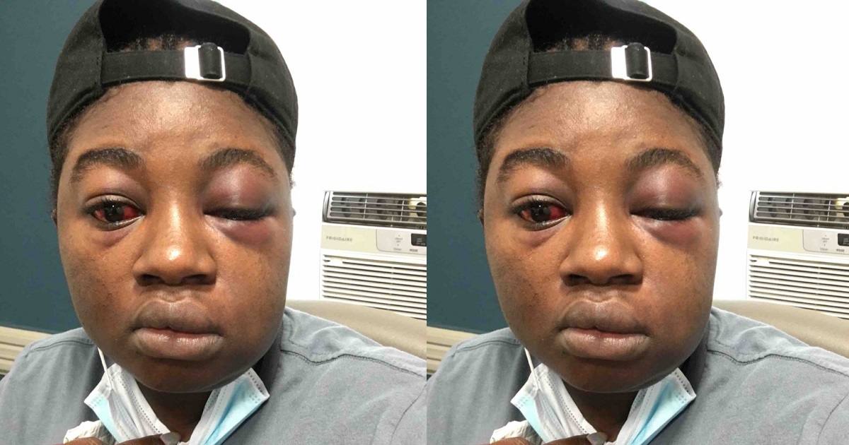 Nigerian Lady tells horrifying story of how she was kidnapped, beaten and raped after she entered a wrong bus.