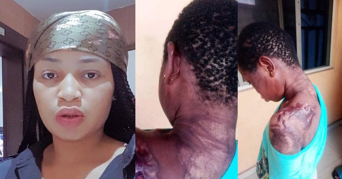 Police arrest lady for dousing 10-year-old maid with hot water mixed with pepper for breaking a plate. (Graphic Photos)