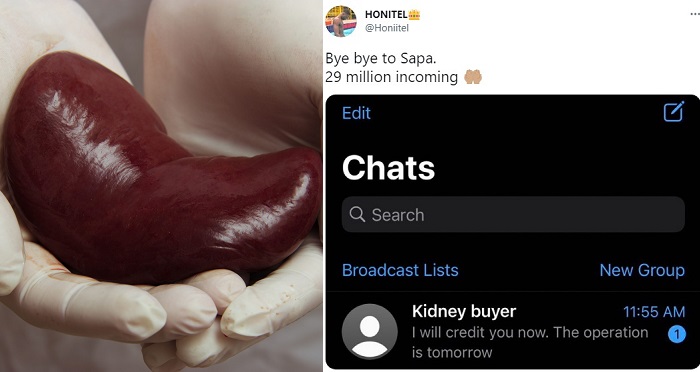 ”Bye Bye to Sapa” – Nigerian man reveals he’s set to sell his kidney for 29 million; Nigerians react