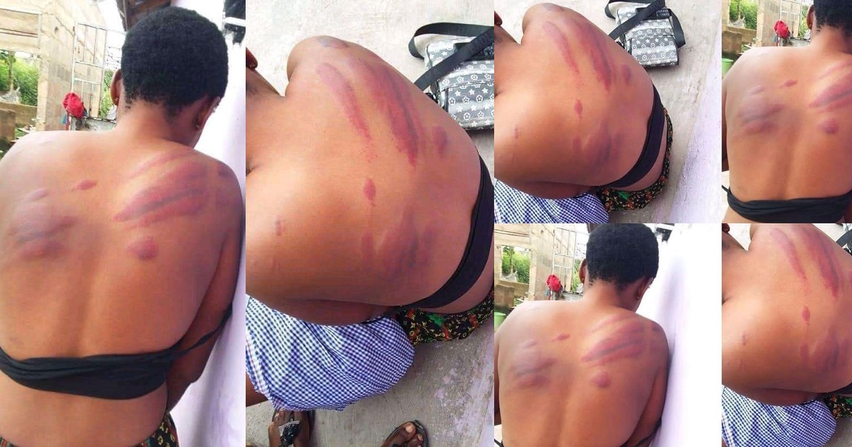 Outrage as school headmaster flogs WASSCE candidate, leaving her with bruises (Photos)