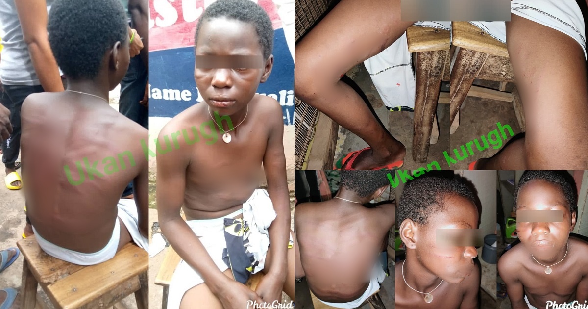 Girl allegedly battered by her stepsister in Benue state (Graphic photos)