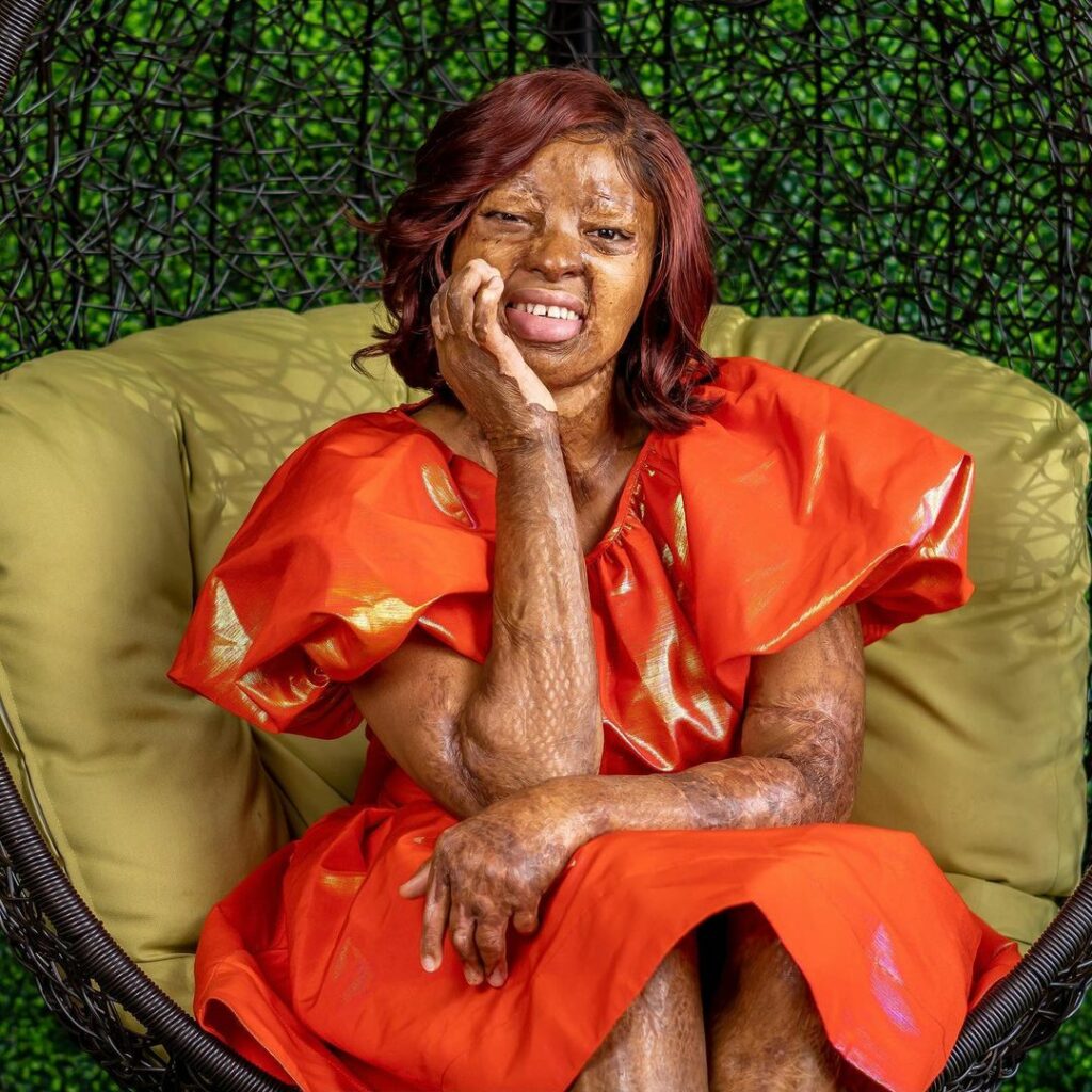 Crash survivor and singer, Kechi, shows off her amazing dance moves