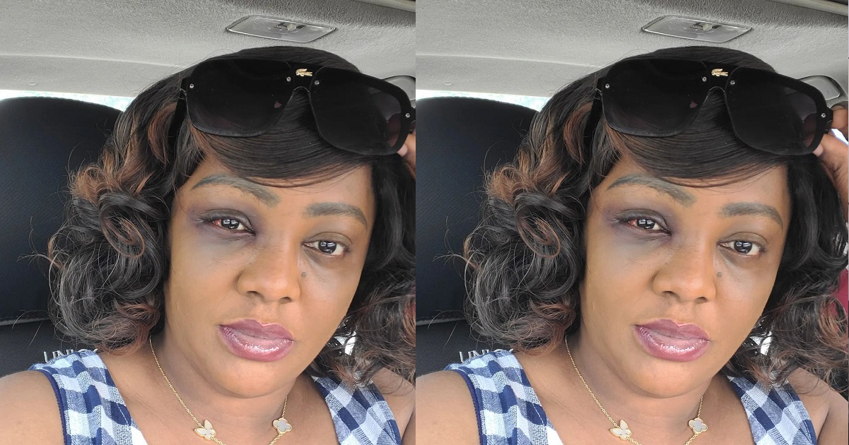 “Sometime ago,I was involved in a car accident in Abuja, I suffered a head concussion” – Helen Paul
