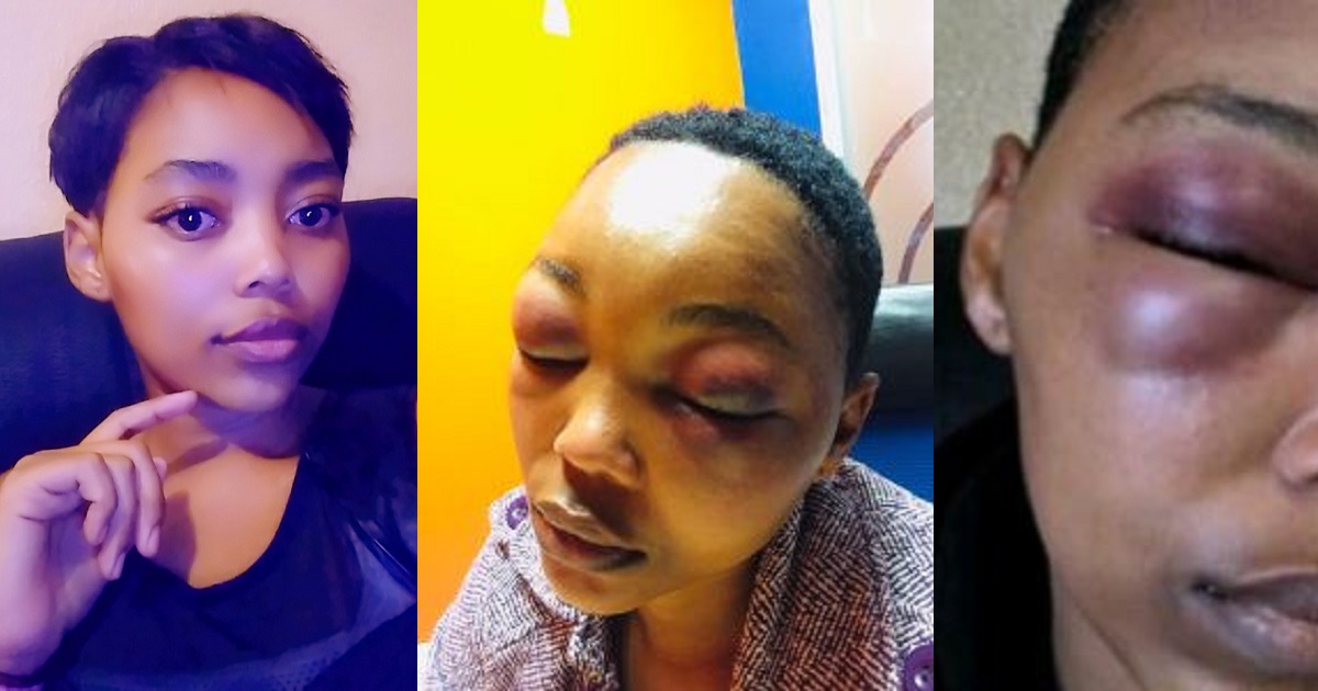 Lady horribly beaten by her boyfriend says police instructed her to “go and talk things through with him”