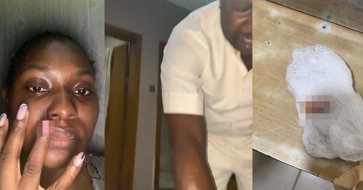 Lawyer calls out her abus!ve husband as she shares photos showing what he did to her. (Videos)