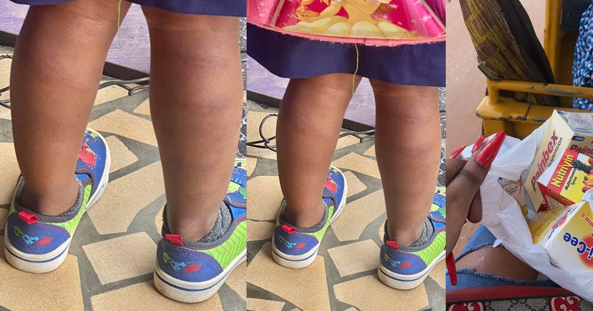 Teacher reportedly brutalizes a 3-year-old pupil (Photos)