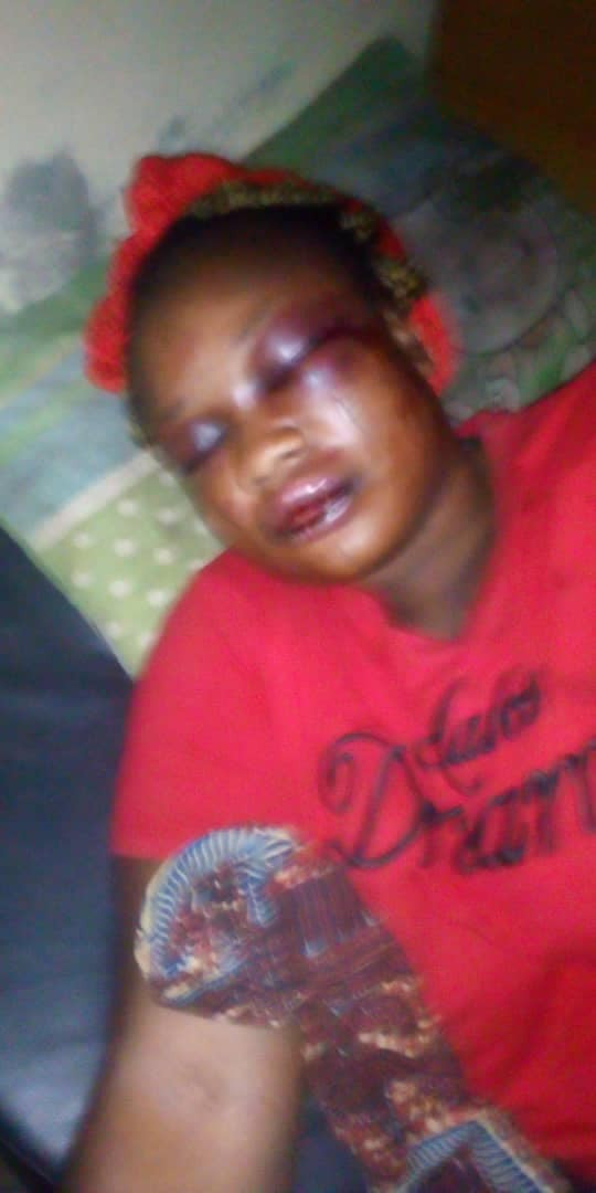 Woman brutally assaulted by her husband over alleged infidelity in Oyo (Photos) 4 ee