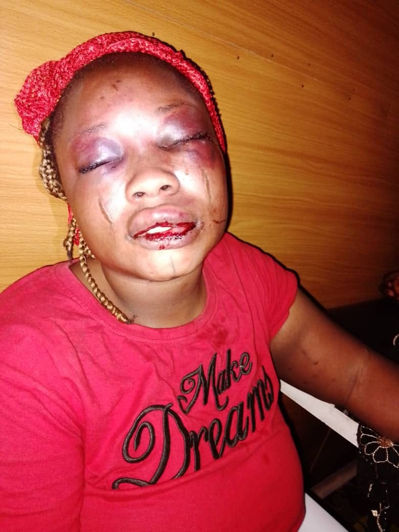 Woman brutally assaulted by her husband over alleged infidelity in Oyo (Photos) 3 qw 3