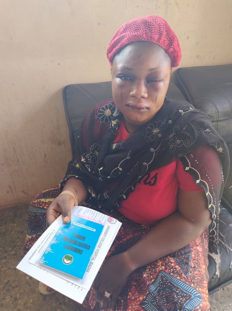 Woman brutally assaulted by her husband over alleged infidelity in Oyo (Photos) 6 yys
