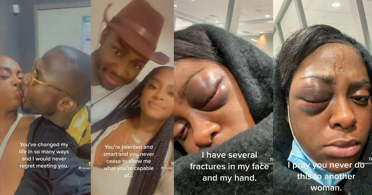 From “God when” to “God abeg” – Woman who ones bragged about her boyfriend’s love for her and called him the best shows injury he inflicted on her (video)