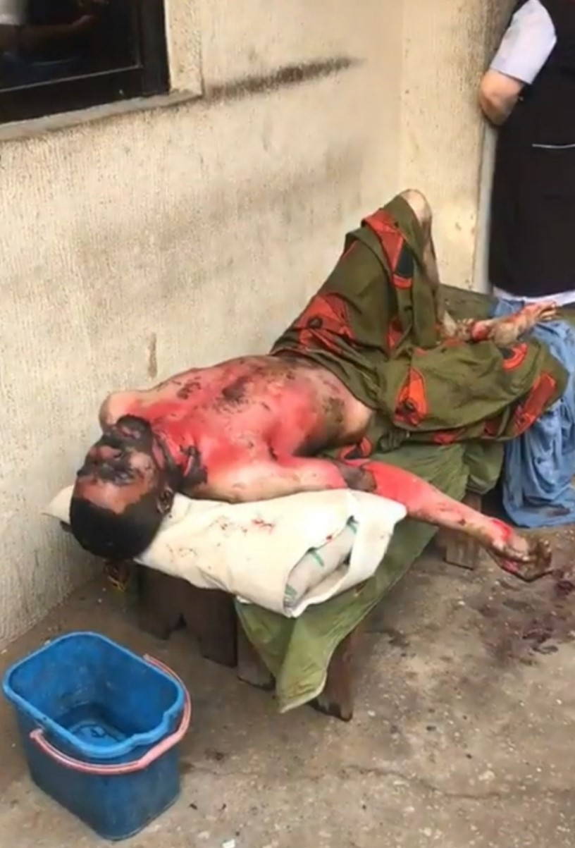 Woman sets her ex-boyfriend on fire in Abia state after she discovered he was about to marry another woman after he dumped her. (video)